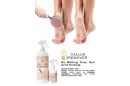 BI Callus Remover Spray 946ml 